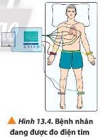 Trong máy đo điện tim, các điện cực được sử dụng để đo hiệu điện thế giữa các điểm khác nhau trên da của bệnh nhân, thường không vượt quá 1 mV đối với người bình